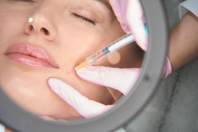 Juvederm Restylane hyaluronic acid filler injection