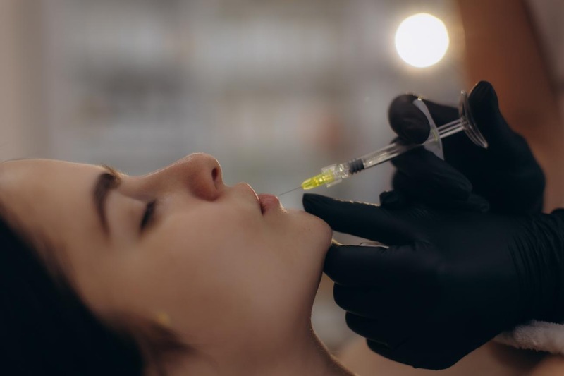 Sculptra collagen-stimulating injectable